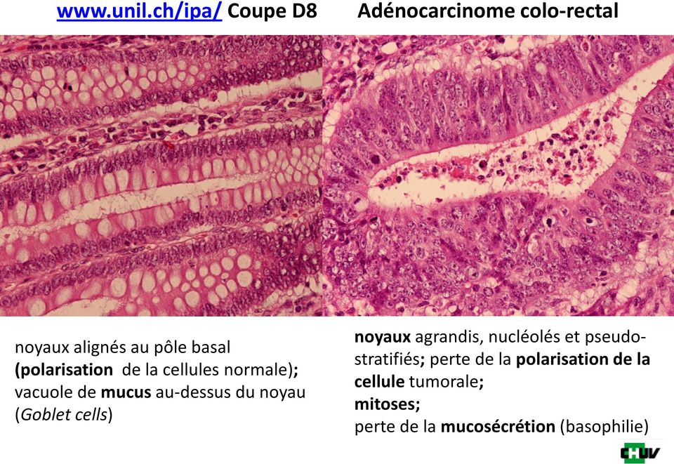 (polarisation de la cellules normale); vacuole de mucus au-dessus du noyau