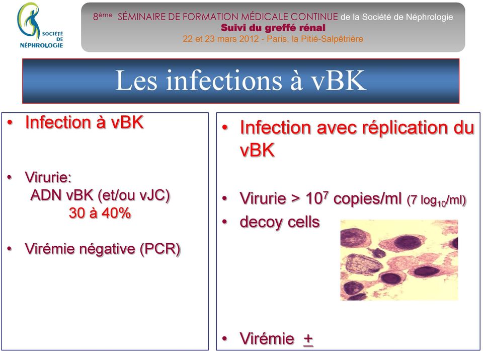 réplication du vbk Virurie > 10 7 copies/ml (7