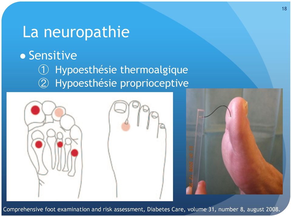 Végétative Comprehensive foot examination and risk