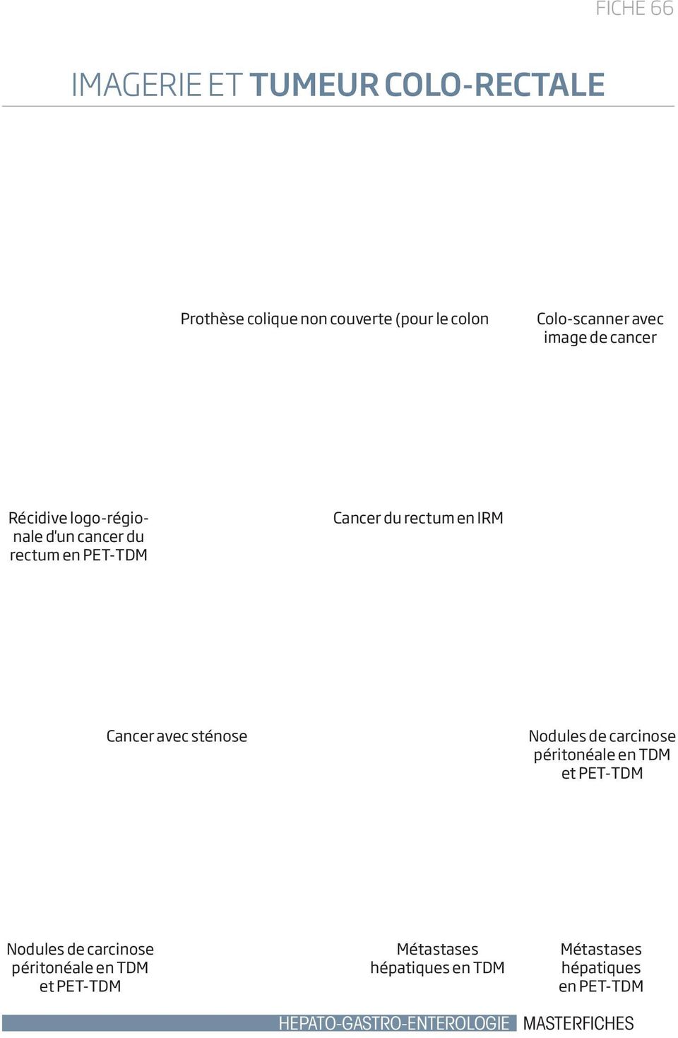 avec sténose Nodules de carcinose péritonéale en TDM et PET-TDM Nodules de carcinose péritonéale en TDM
