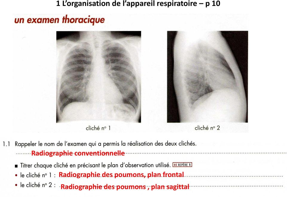conventionnelle Radiographie des