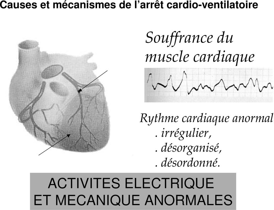 cardiaque Rythme cardiaque anormal. irrégulier,.