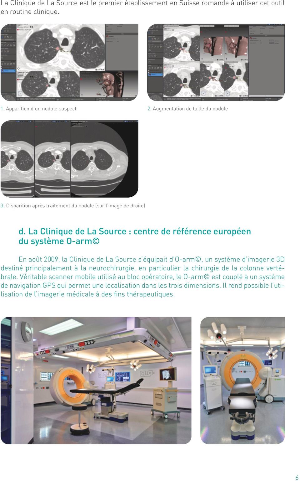 La Clinique de La Source : centre de référence européen du système O-arm En août 2009, la Clinique de La Source s équipait d O-arm, un système d imagerie 3D destiné principalement à la