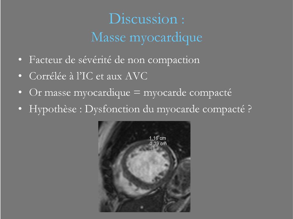 aux AVC Or masse myocardique = myocarde