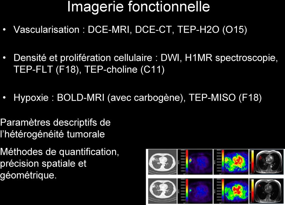 (C11) Hypoxie : BOLD-MRI (avec carbogène), TEP-MISO (F18) Paramètres descriptifs de