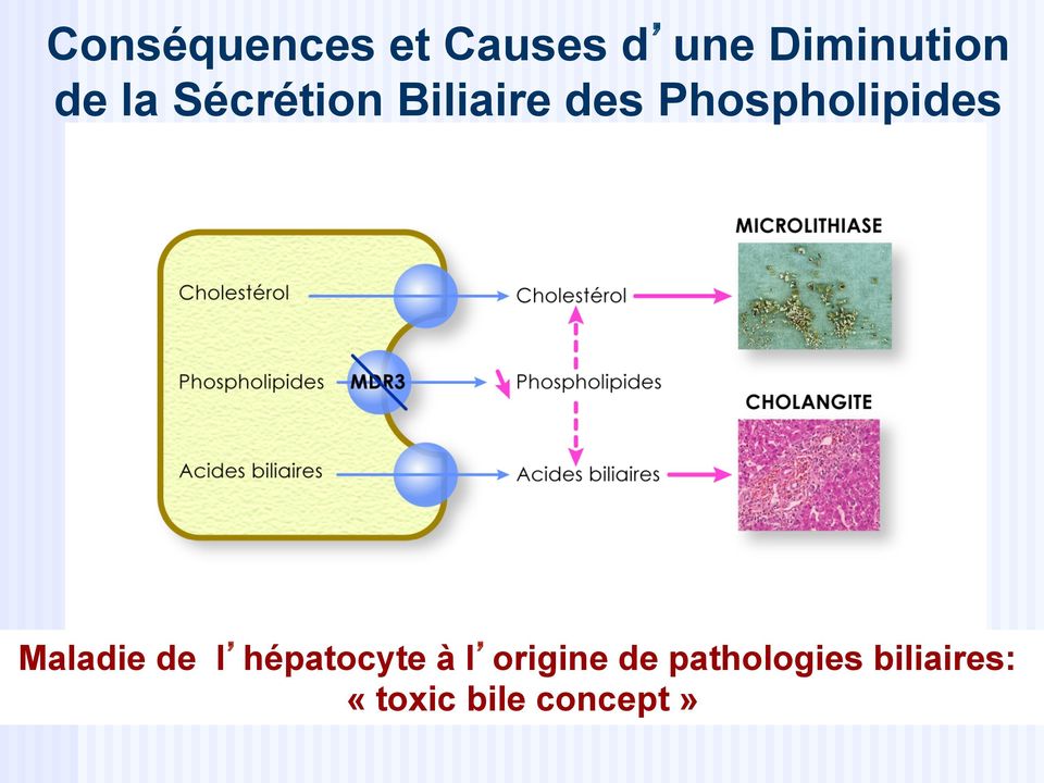 Phospholipides Maladie de l hépatocyte à