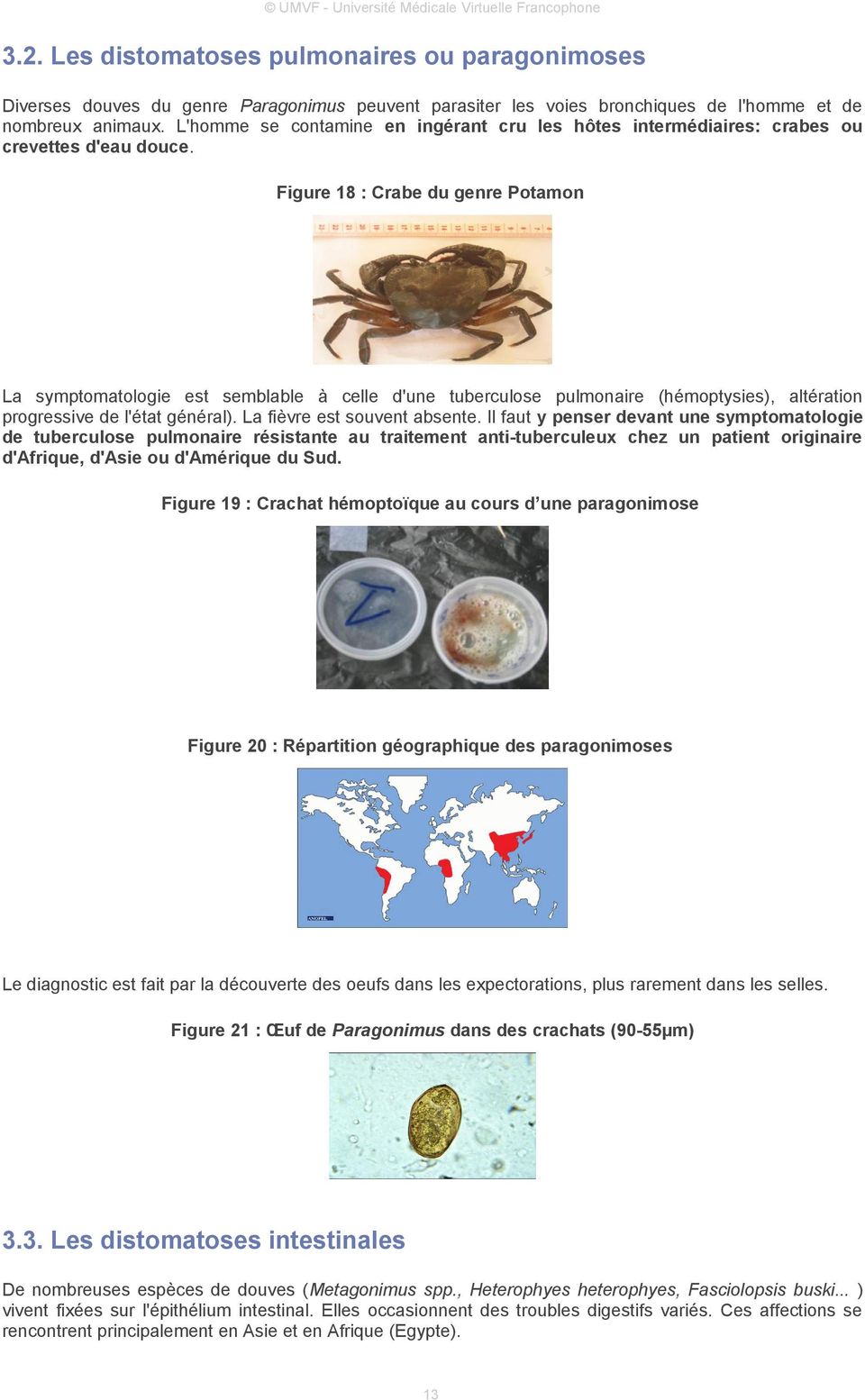 Figure 18 : Crabe du genre Potamon La symptomatologie est semblable à celle d'une tuberculose pulmonaire (hémoptysies), altération progressive de l'état général). La fièvre est souvent absente.