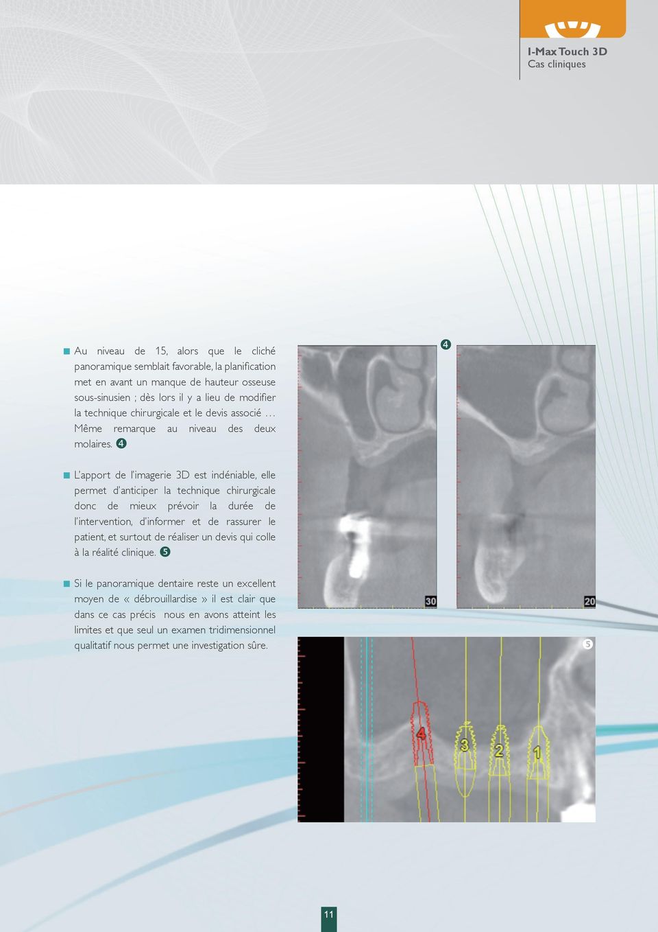 L apport de l imagerie 3D est indéniable, elle permet d anticiper la technique chirurgicale donc de mieux prévoir la durée de l intervention, d informer et de rassurer le patient, et surtout