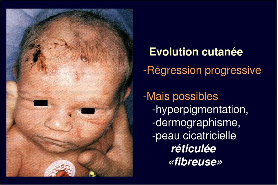 possibles -hyperpigmentation,