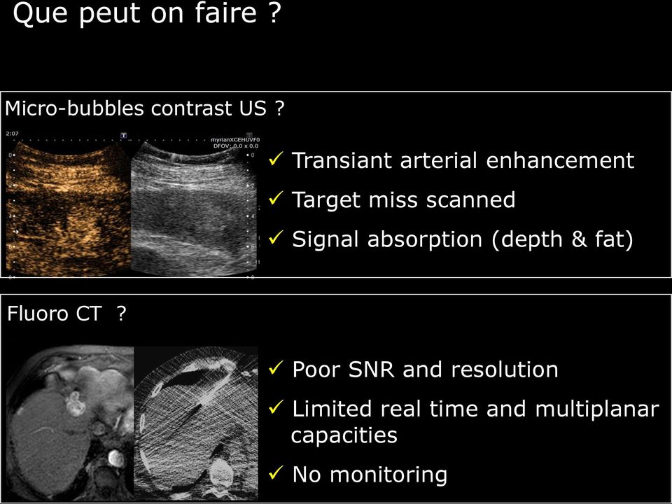 Signal absorption (depth & fat) Fluoro CT?
