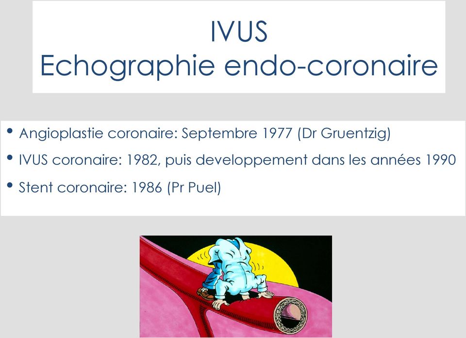 IVUS coronaire: 1982, puis developpement