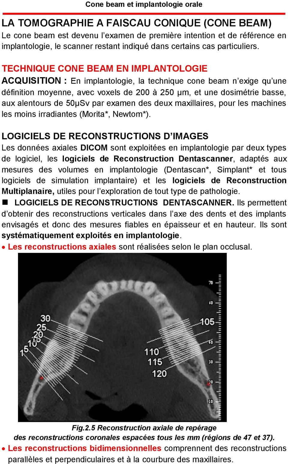 50µSv par examen des deux maxillaires, pour les machines les moins irradiantes (Morita*, Newtom*).