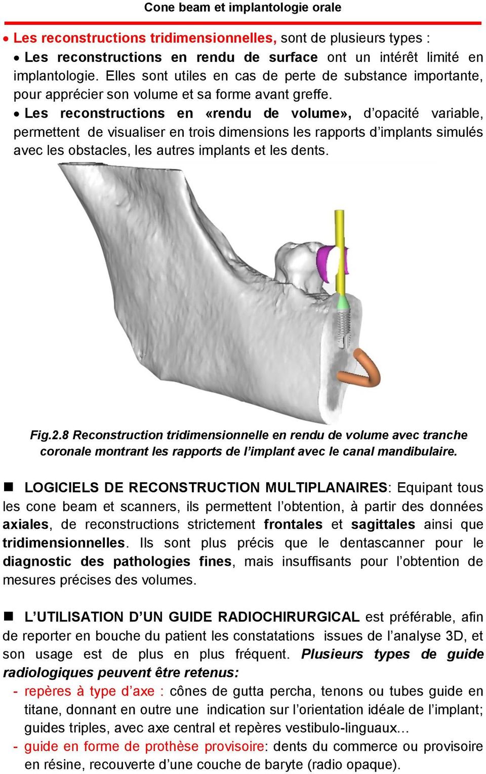 Les reconstructions en «rendu de volume», d opacité variable, permettent de visualiser en trois dimensions les rapports d implants simulés avec les obstacles, les autres implants et les dents. Fig.2.