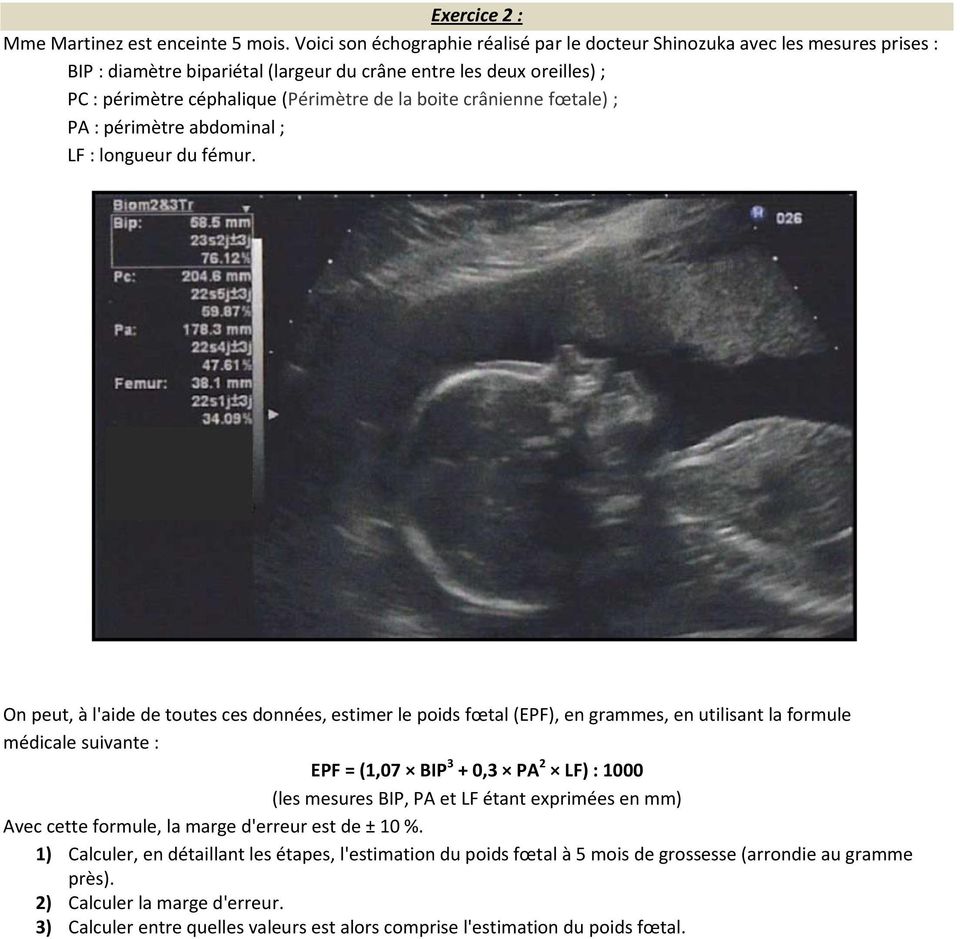 boite crânienne fœtale) ; PA : périmètre abdominal ; LF : longueur du fémur.