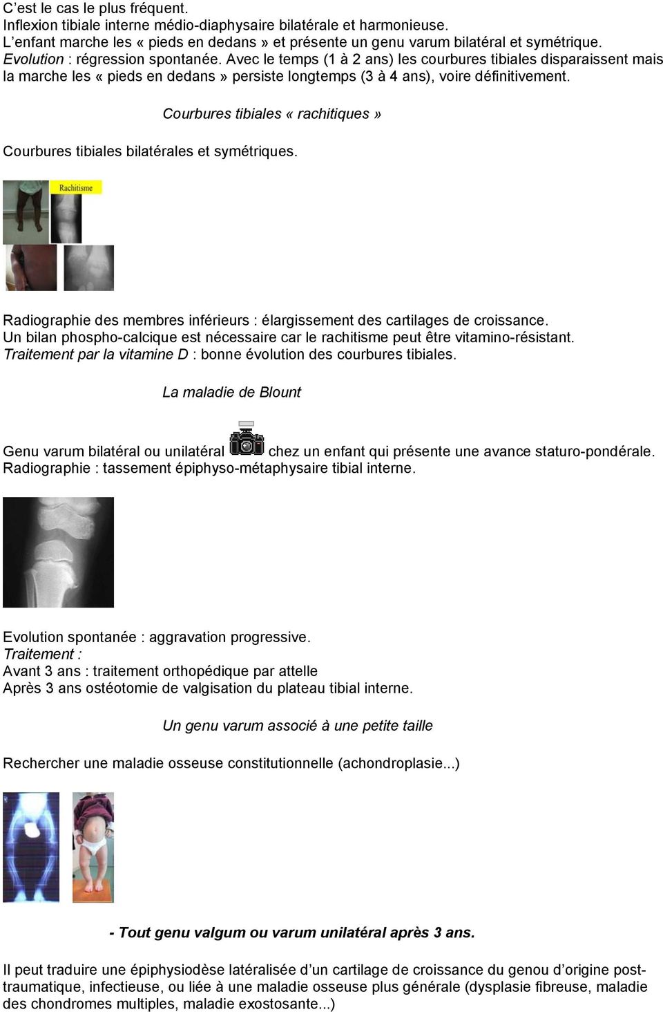 Courbures tibiales «rachitiques» Courbures tibiales bilatérales et symétriques. Radiographie des membres inférieurs : élargissement des cartilages de croissance.