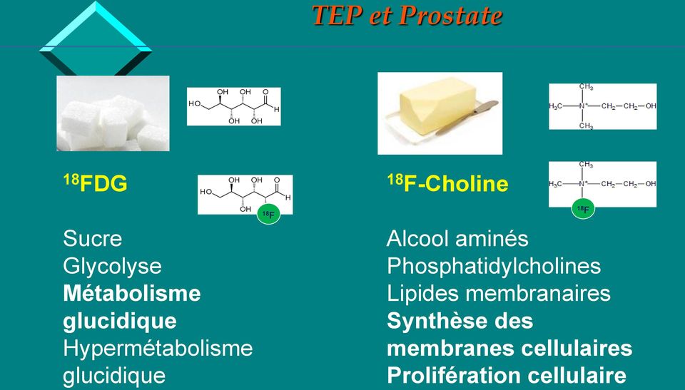 18 F Alcool aminés Phosphatidylcholines Lipides