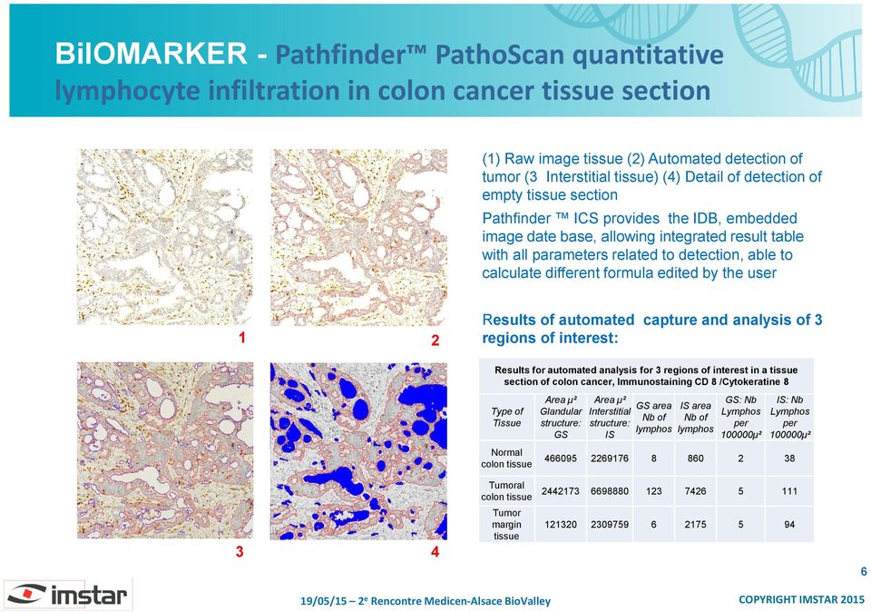 formula edited by the user 1 2 Results of automated capture and analysis of 3 regions of interest: Results for automated analysis for 3 regions of interest in a tissue section of colon cancer,