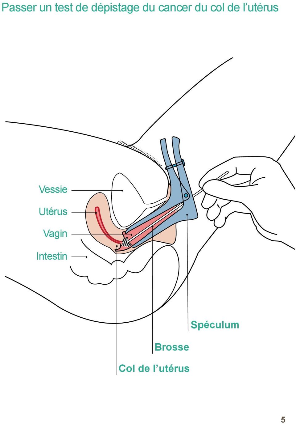 Vessie Utérus Vagin Intestin