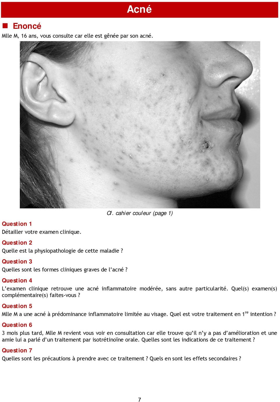 Quel(s) examen(s) complémentaire(s) faites-vous? Question 5 Mlle M a une acné à prédominance inflammatoire limitée au visage. Quel est votre traitement en 1 re intention?