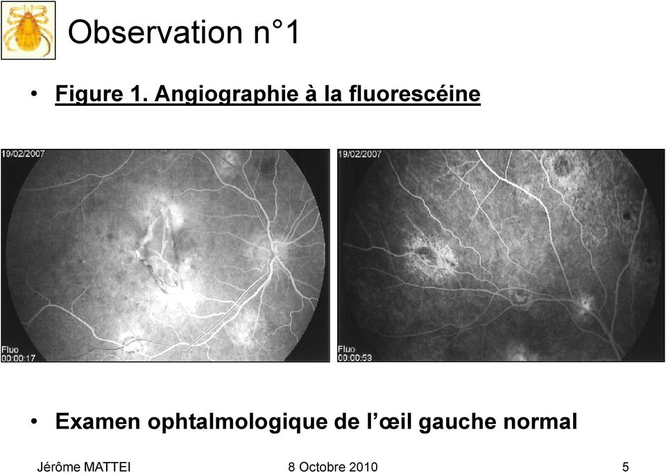 Examen ophtalmologique de l œil