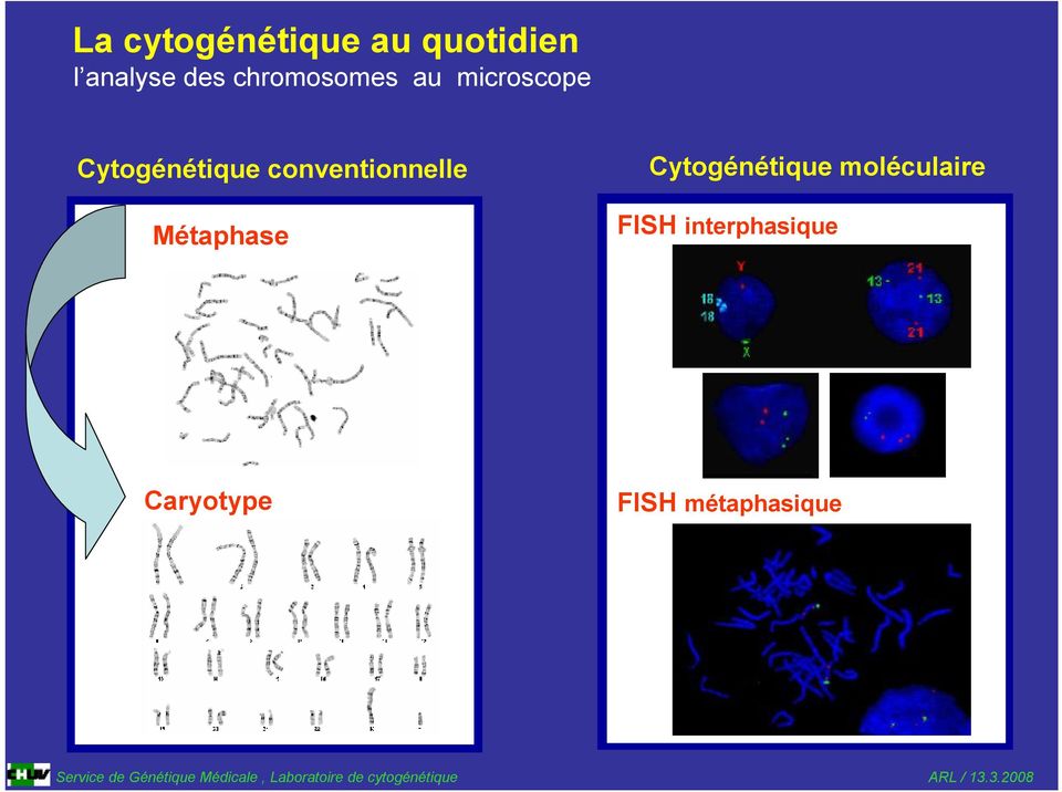 conventionnelle Métaphase Cytogénétique