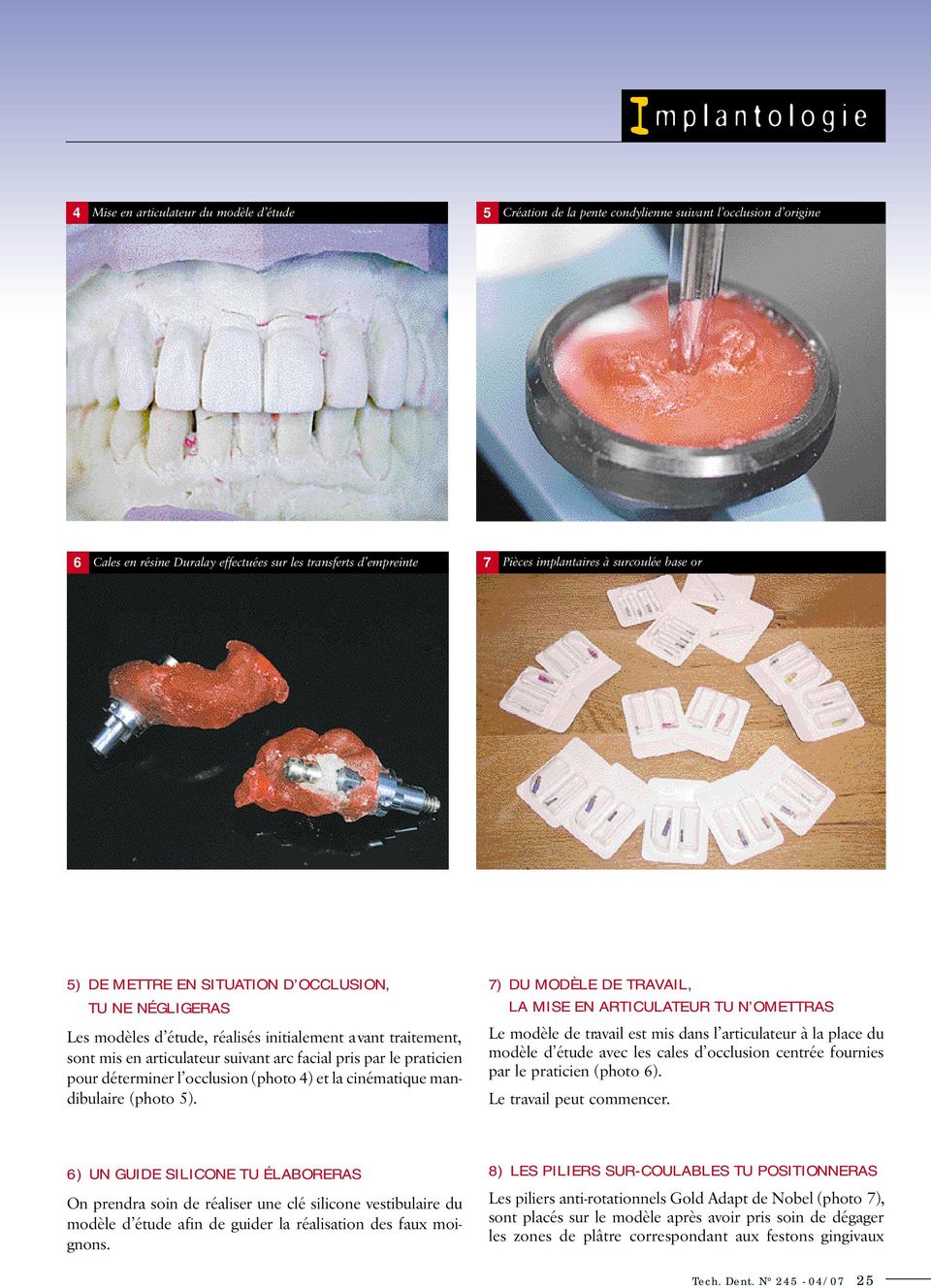 praticien pour déterminer l occlusion (photo 4) et la cinématique mandibulaire (photo 5).