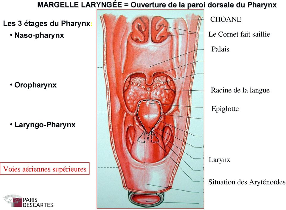 Oropharynx Racine de la langue Epiglotte Laryngo-Pharynx Larynx