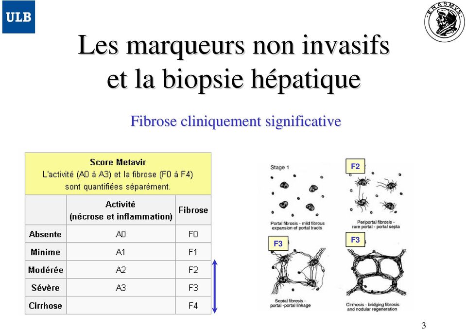 hépatique h Fibrose