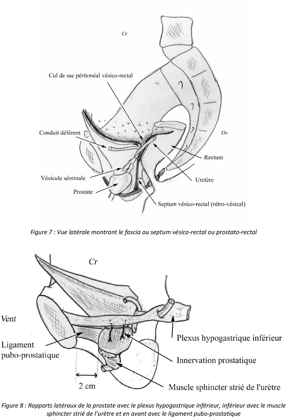 avec le plexus hypogastrique inférieur, inférieur avec le muscle