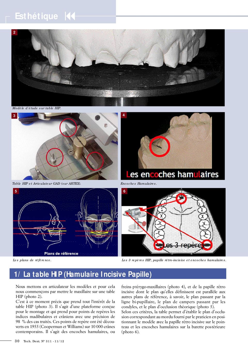 1/ La table HIP (Hamulaire Incisive Papille) Nous mettons en articulateur les modèles et pour cela nous commençons par mettre le maxillaire sur une table HIP (photo 2).