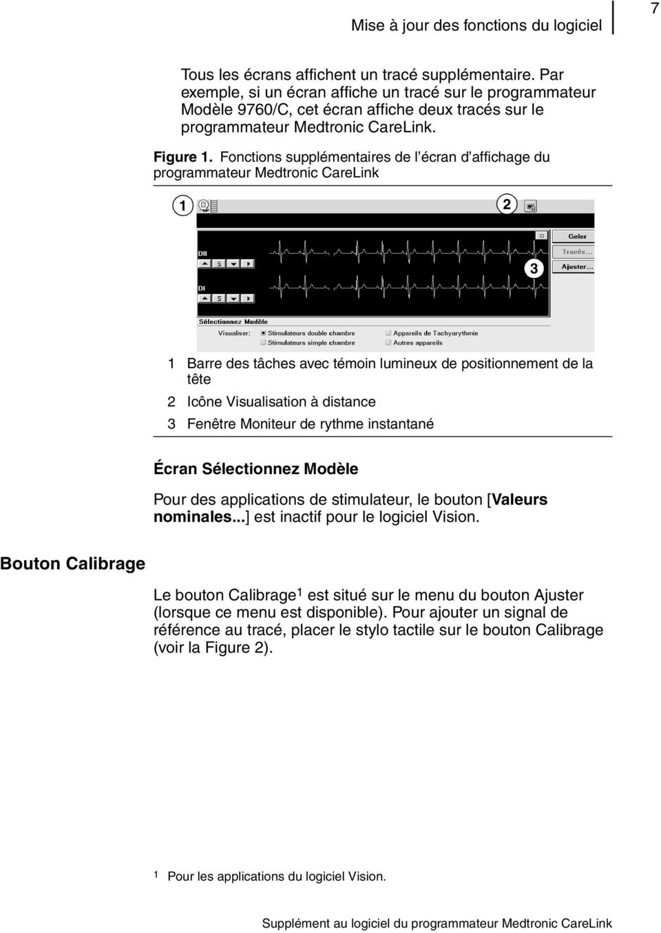 Fonctions supplémentaires de l écran d affichage du programmateur Medtronic CareLink 1 2 3 1 Barre des tâches avec témoin lumineux de positionnement de la tête 2 Icône Visualisation à distance 3