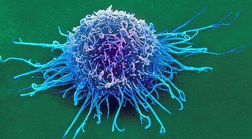 La cellule cancéreuse