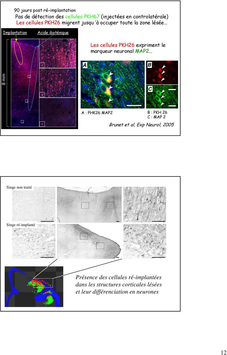 neuronal MAP2 1 A B 8 mm 1 2 C 2 3 3 A : PHK26 MAP2 B : PKH 26 C : MAP 2 Brunet et al, Exp Neurol, 2005 Singe non traité