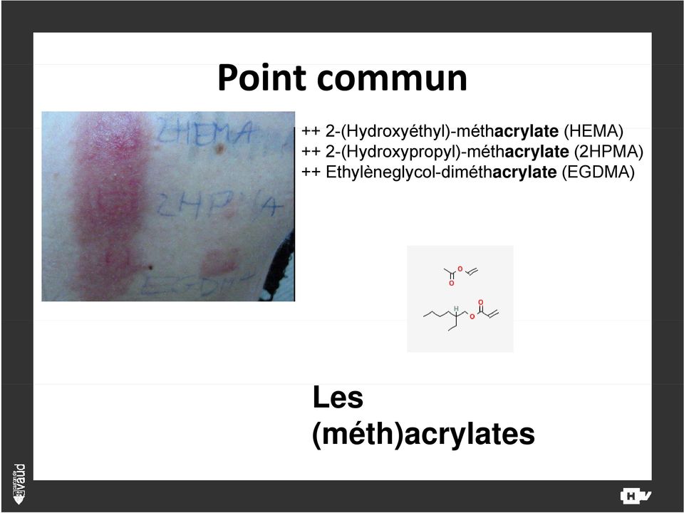 ++ 2-(Hydroxypropyl)-méthacrylate