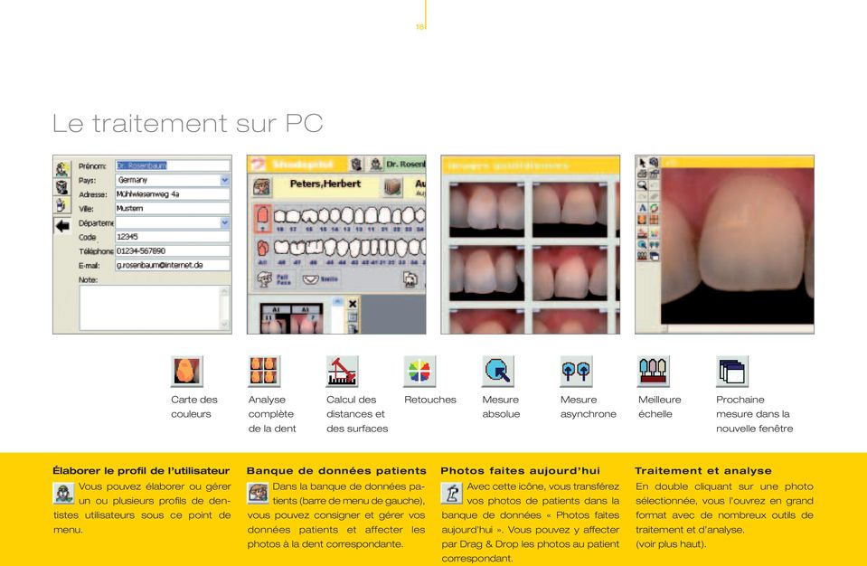 utilisateurs sous ce point de menu. Dans la banque de données patients (barre de menu de gauche), vous pouvez consigner et gérer vos données patients et affecter les photos à la dent correspondante.