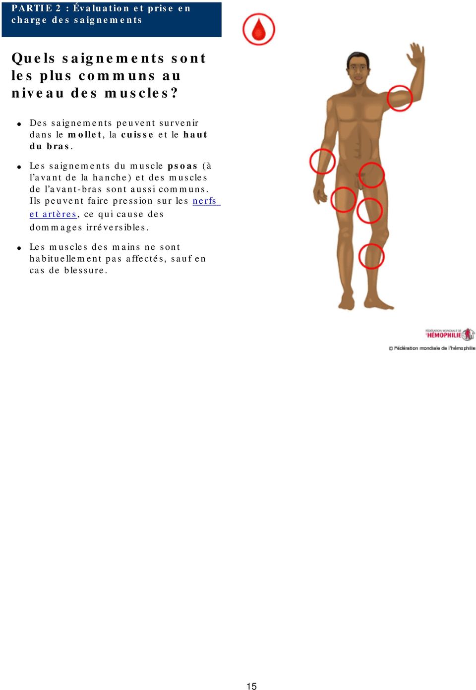 Les saignements du muscle psoas (à l avant de la hanche) et des muscles de l avant-bras sont aussi communs.