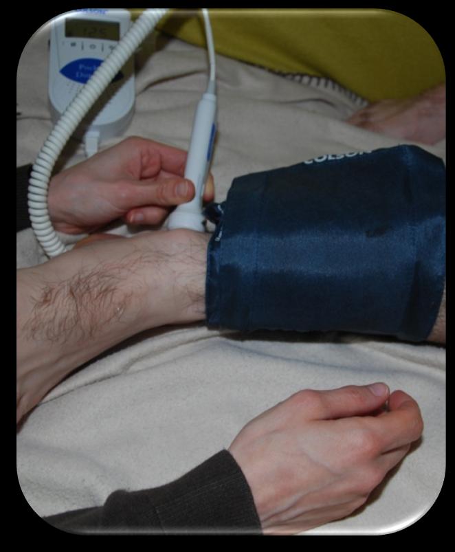 III TECHNIQUE DE RÉALISATION : Au membre inférieur : Sonde sur le dos du pied (artères pédieuses) ou à la cheville