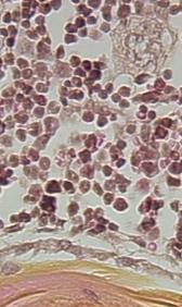 Syndécan-2 = suppresseur de tumeur Cellules K7M2 sont dérivées d un ostéosarcome spontané chez la souris BalB/c K7M2