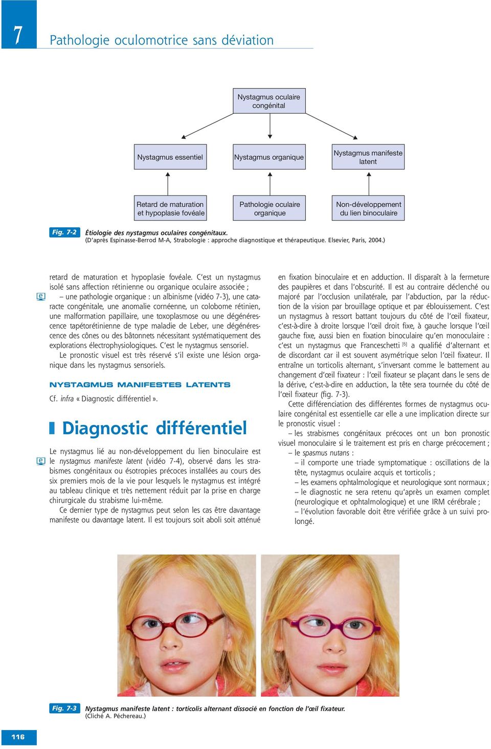 Elsevier, Paris, 2004.) e e retard de maturation et hypoplasie fovéale.