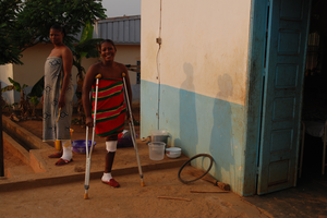 Besoin de formation important pour la prise en soins des plaies Pavillon de référence pour l ulcère de Buruli* à l Hôpital de district d Akonolinga, dans la région de Yaoundé Centre de santé