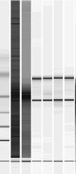 Qualité des ARNs extraits après conservation dans le RNA later Tumeurs Pulmonaires Importance du délai de prise en charge du prélèvement M1a1b2a2b 3 4 1 9 2 4 2 9 3 4 3 9 4 4 4 9 5 4 5 9 6 4 1a - Ros