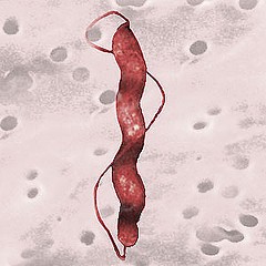 Campylobacter jejuni Réservoir : tube digestif des volailles Conditions propices : 42 C, thermotolérante microaérophile, Aliments concernés