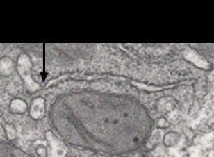 IV- Le cytoplasme Le cytoplasme est constitué d une substance fondamentale dans laquelle baignent les organites cytoplasmiques, le cytosquelette et diverses inclussions.