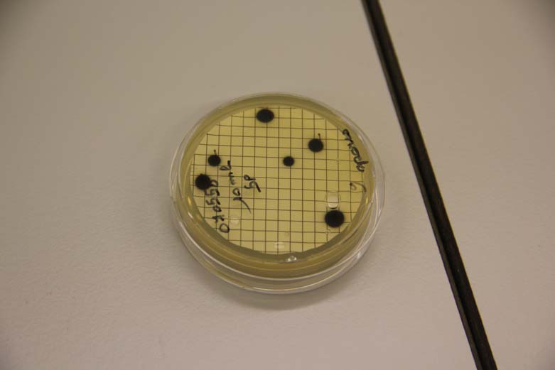 Annexe 3 : Photos Filtration de 100ml de l échantillon Aspect des colonies sur la gélose