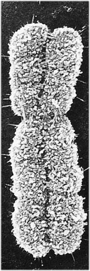 Morphologie des chromosomes en métaphase Télomères