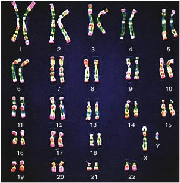 3/ Le caryotype Ensemble des chromosomes d une cellule, rangés en fonction de la taille, de la forme et du nombre
