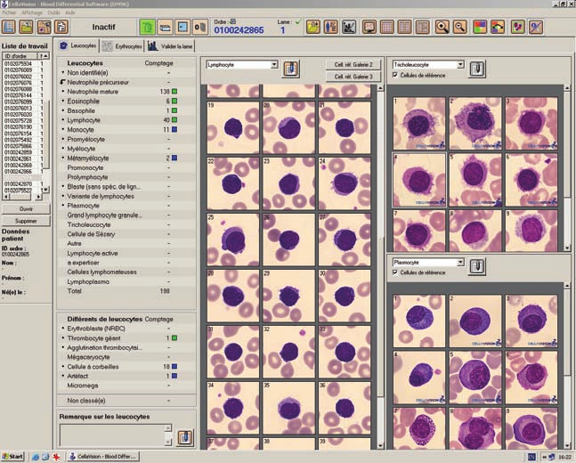 article original la population lymphocytaire. Le zoom sur une cellule est possible, mais il s agit d un zoom numérique à quantité de pixels fixe.