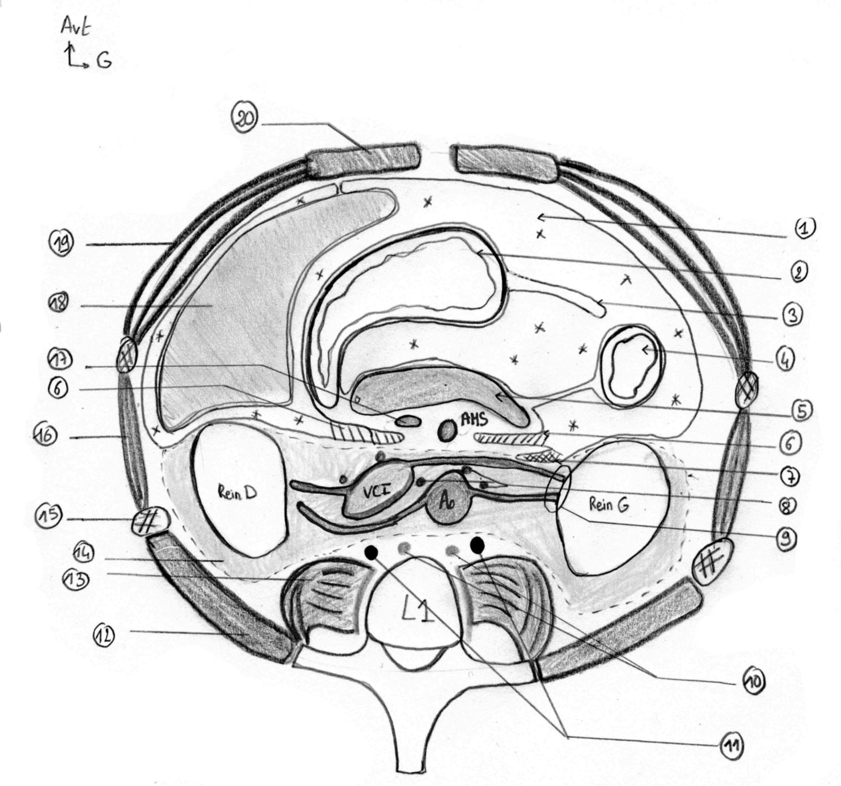 RVU Bases anatomiques des masses rétropéritonéales Coupe de l abdomen en L1 1 :Cavité péritonéale 2 : Estomac 3 : Grand omentum 4 : Angle colique gauche 5 : Pancréas 6 : Fascias de Treitz 7 : Fascias
