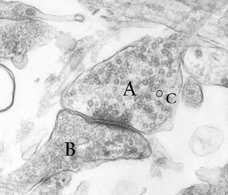 Question n 28 Cette photo prise au microscope électronique à transmission correspond Contrôle n 2 novembre 2012 Terminale S 10 A- A une synapse B- A une plaque motrice C- A un fuseau neuromusculaire