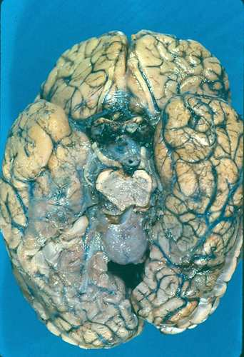 Figure 3 : Vue supérieure du cerveau Figure 4 : Vue inférieure du cerveau 2.